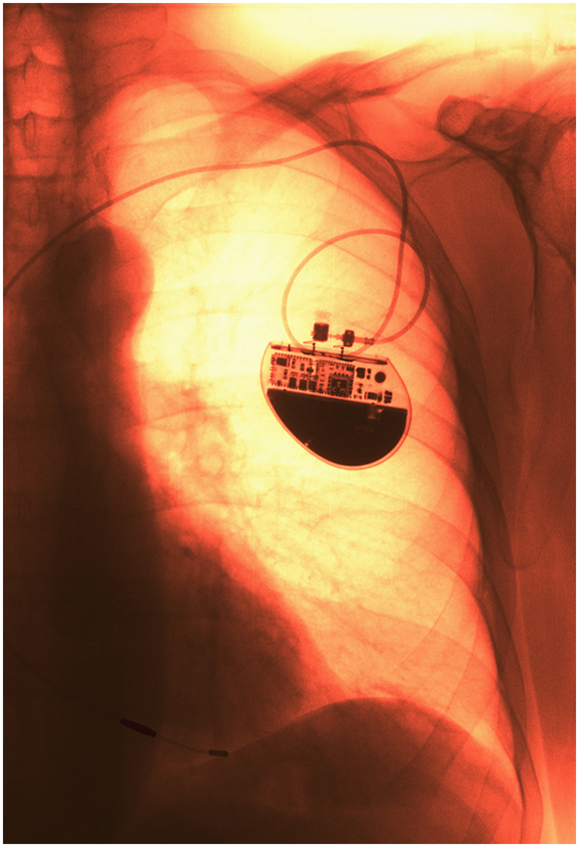 graphical abstract for How can innovative design strategies in biotechnology address biocompatibility and signal processing challenges in next-generation bioelectronic interfaces? - open in full screen